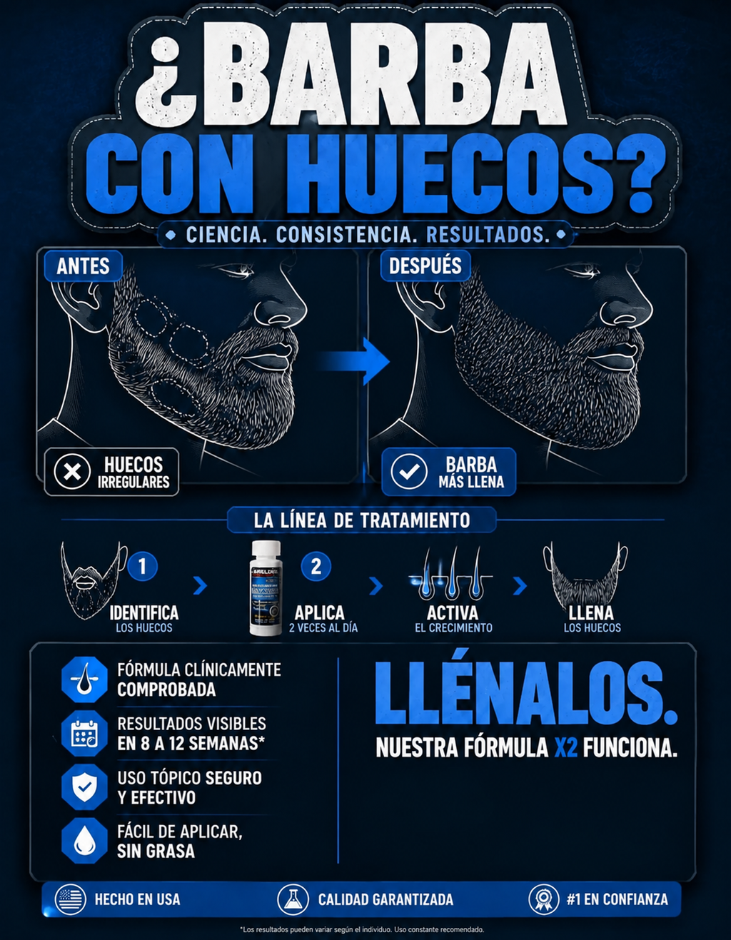 KIT MINOXIDIL KIRKLAND 5% + DERMAROLLER + GOTERO